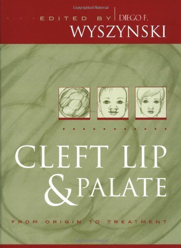Cleft Lip and Palate: From Origin to Treatment On Sale