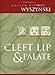 Cleft Lip and Palate: From Origin to Treatment