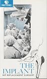 The Implant; Hip Replacement Surgery [VHS Video by PBS]
