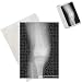 Photo Jigsaw Puzzle of X-Ray Left Knee Joint Lateral View from Cmsp