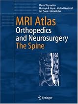 MRI Atlas: Orthopedics and Neurosurgery, the Spine