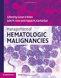 Management of hematologic malignancies