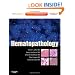 Hematopathology: Expert Consult - Online and Print, 1e