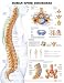 Human Spine Disorders Anatomy 3D Raised Chart/Poster
