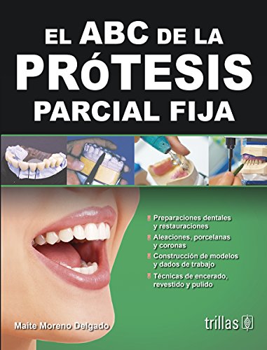 El ABC de la prótesis parcial fija / The ABCs of fixed partial denture (Spanish Edition)