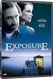 Exposure