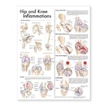 Hip and Knee Inflammations Anatomical...
