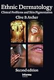 Ethnic dermatology : clinical problems and pigmented skin