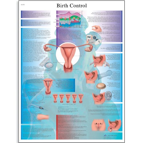 contraception