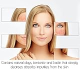 Clay Mint Healing Mask- Best facial treatment to minimize pores & clears your skin from acne, acne scars, pimples, whiteheads & blackheads. Can be use