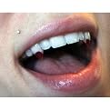 Blood Tip Fangs - Small
