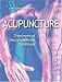 Acupuncture: Treatment of Musculoskeletal Conditions