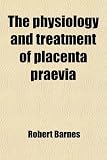 The physiology and treatment of placenta praevia