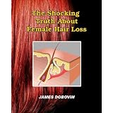 The Shocking Truth About Female Hair Loss: Secrets You Need to Know About Losing Hair So You Can Stop From Going Bald ~ James Dobovin
