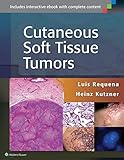 Cutaneous soft tissue tumors
