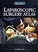 Search : Laparoscopic Surgery Atlas