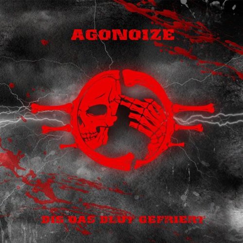 Agonoize Picture 2