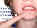 How to Get Rid Of Acne How to Get Rid Of Acne