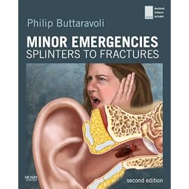 Minor Emergencies: Splinters to Fractures