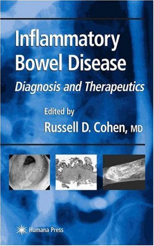 Inflammatory-Bowel-Disease