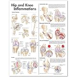 Hip and Knee Inflammations Anatomical Chart