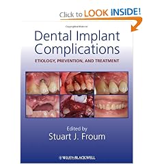Click here to buy Dental Implant Complications: Etiology, Prevention, and Treatment by Stuart J. Froum.