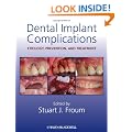 Dental Implant Complications: Etiology, Prevention, and Treatment