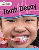 Tooth decay