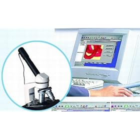DIGITAL EYEPIECE