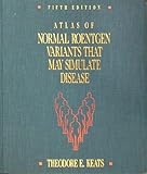 Atlas of normal roentgen variants that may simulate disease