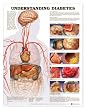 Understanding Diabetes Anatomical Chart Laminated (Poster)