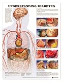 Understanding Diabetes Anatomical Chart Laminated (Poster)-9755PL1.5