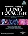 Principles and Practice of Lung Cancer: The Official Reference Text of the International Association for the Study of Lung Cancer (IASLC) (Pass, Lung Cancer)