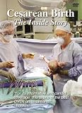 Cesarean Birth: The Inside Story DVD