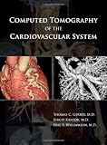 Computed Tomography of the Cardiovascular System