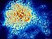 Hepatitis B Virus Electron Micrograph Tem Photographic Poster Print, 16x12