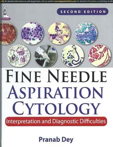 Fine Needle Aspiration Cytology Interpretation and Diagnostic Difficulties