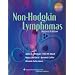 Non-Hodgkin Lymphomas