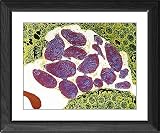 Framed Prints of Toxoplasmosis from Science Photo Library