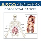 Colorectal Cancer Fact Sheet (pack of 125 fact sheets)