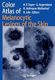 Color Atlas of Melanocytic Lesions of the Skin Color Atlas of Melanocytic Lesions of the Skin