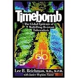 timebomb  the global epidemic of multi drug resistant tuberculosis
