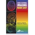 Cross-Sectional Imaging Made Easy by Simon Jackson and Richard Thomas