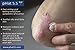 Eczema Lotion by pHat5.5