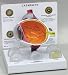 Cataract Eye Model