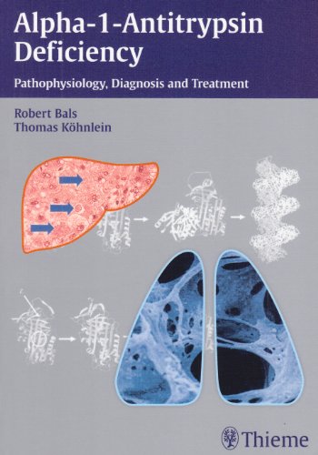 Geometry Net Health Conditions Books Alpha 1 Antitrypsin Deficiency