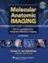 Molecular Anatomic Imaging: PET-CT and SPECT-CT Integrated Modality Imaging