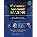 Molecular Anatomic Imaging: PET-CT and SPECT-CT Integrated Modality Imaging