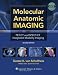 Molecular Anatomic Imaging: PET-CT and SPECT-CT Integrated Modality Imaging
