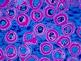 Electron Microscopy of Toothbrush Tips X75 Photographic Poster Print, 24x18